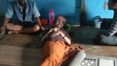 Berikut Harapan Orangtua Abdullah, Remaja Penderita Hidrosefalus di Desa Panton Bayam